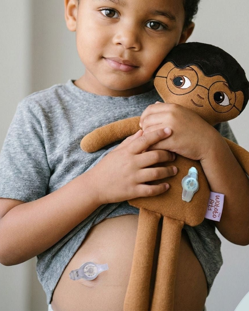 Mjuk docka med gastrostomiknapp/PEG knapp i magen| Watoto Arts