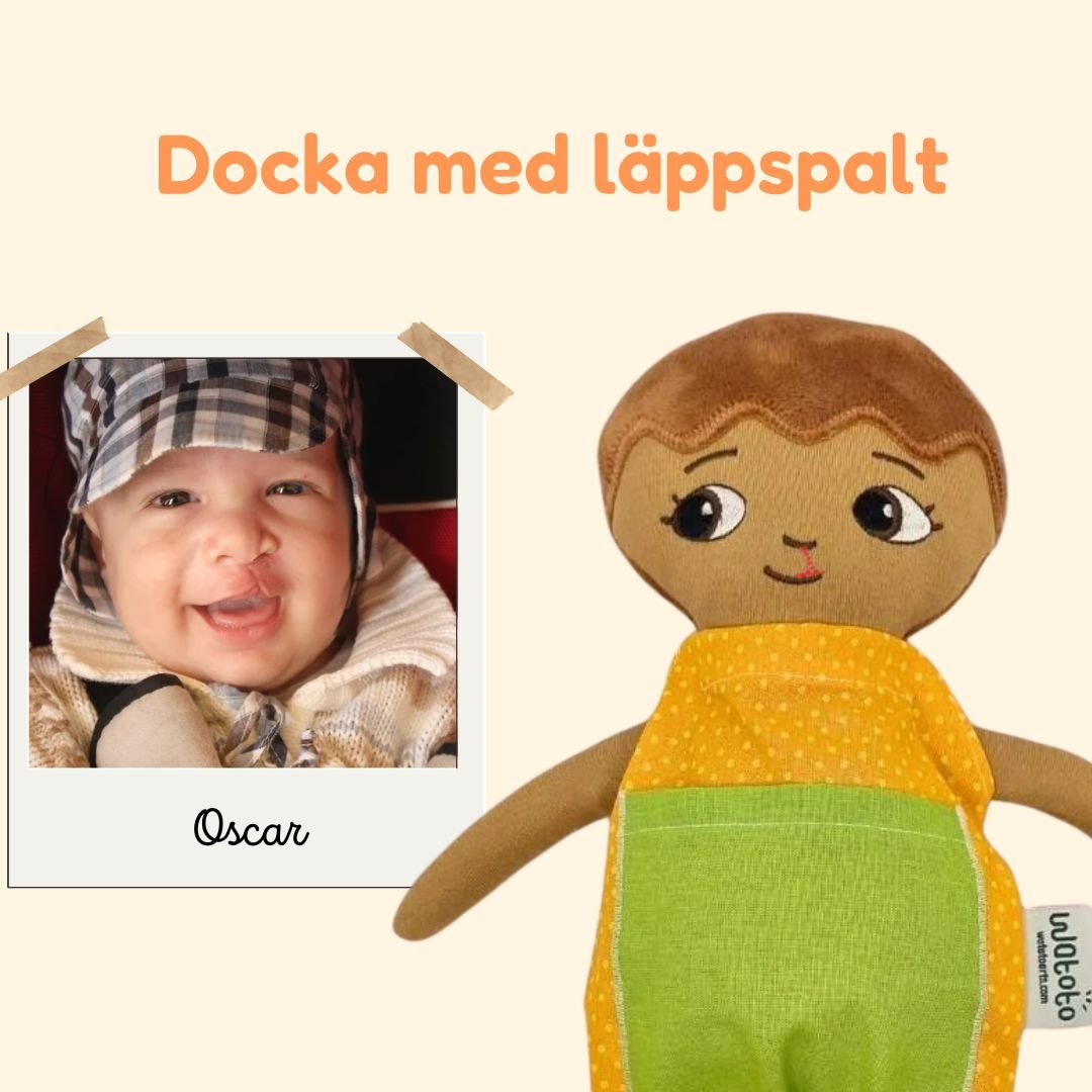 Docka med läppspalt – en viktig förebild för barn med läppspalt, käkspalt eller gomspalt - Watotoarts.com