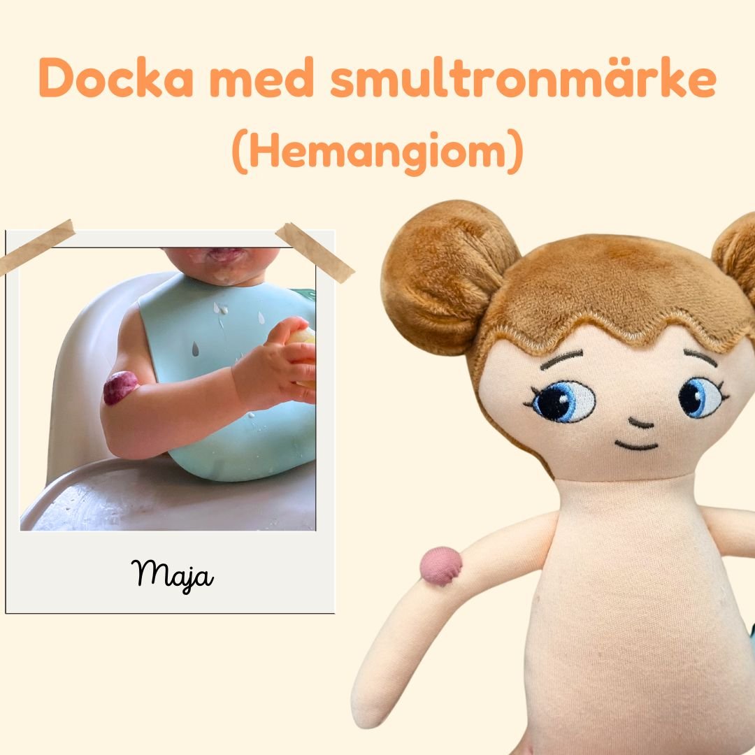 En docka med smultronmärke/Hemangiom - Watotoarts.com