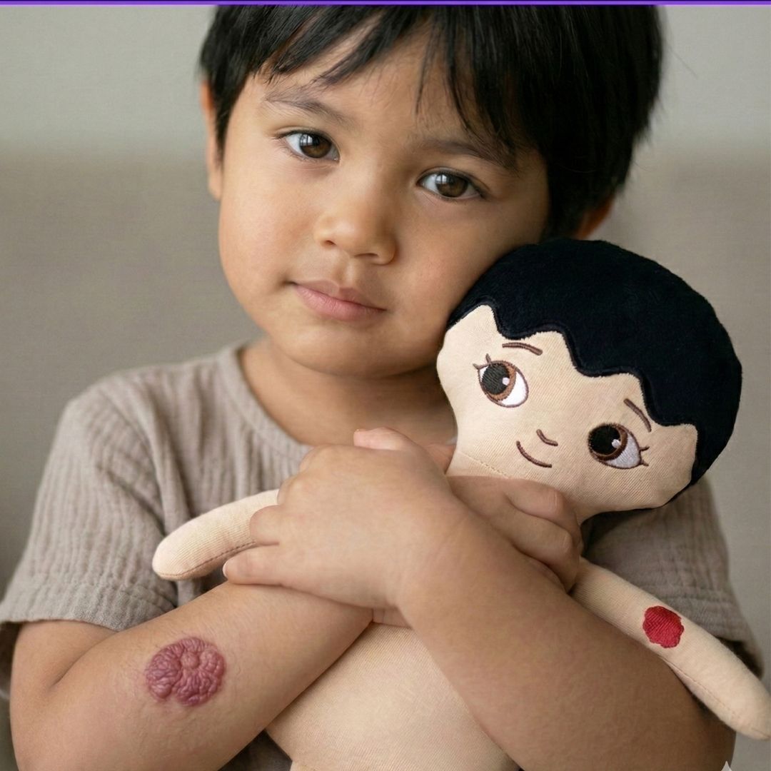 Mjuk docka med smultronmärke eller elds märke - Hemangiom | Watoto Arts